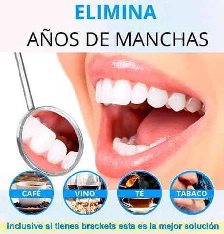 Blanqueamiento Dental